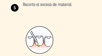 Instrucciones cemento seTpp 5